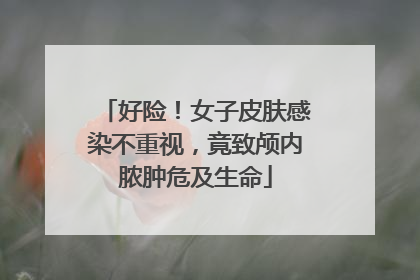 好险！女子皮肤感染不重视，竟致颅内脓肿危及生命